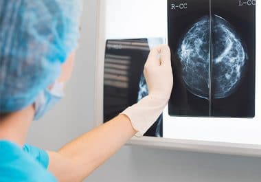 Less Treatment Is More for Early-stage Breast Cancer