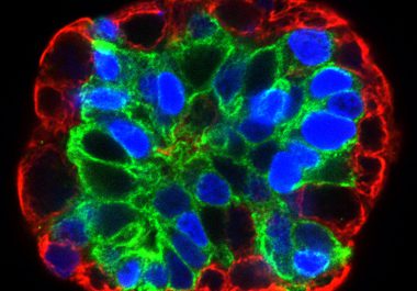 NCI Collection Offers a Look at “Cancer Close Up”