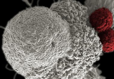 Immunotherapeutic Approved for Fourth Cancer Type