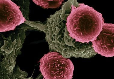 Catalyzing Progress in Cancer Immunotherapy