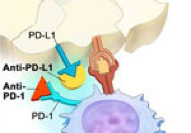 First Immunotherapy-Companion Diagnostic Combo for Advanced Lung Cancer