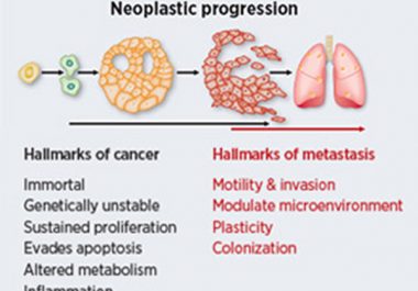 Identifying the Hallmarks of Cancer Metastasis