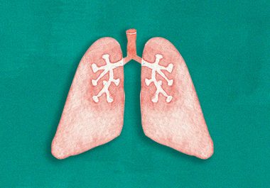 Targeted Therapy for Early-Stage Lung Cancer?