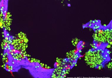 Targeting Multiple Myeloma