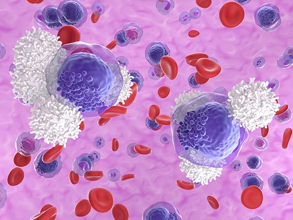 Bispecific Antibody Indication Expanded For Acute Lymphoblastic Leukemia | Research | AACR