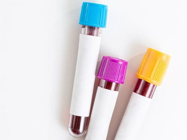 What Is Liquid Biopsy? 