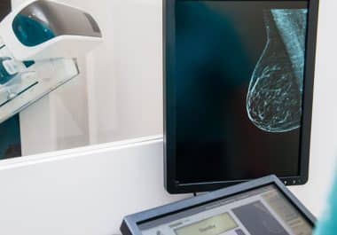 Understanding the Federal Rule on Breast Tissue Density Reports