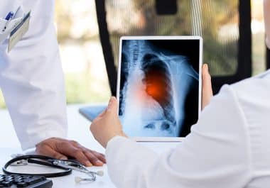 Nivolumab Approved for Neoadjuvant and Adjuvant Treatment of Non-small Cell Lung Cancer