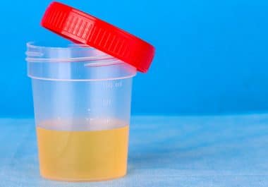 Urine Tests: Can Detecting Cancer Become Easy Pee-sy?