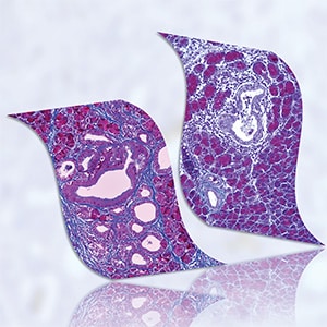 Magnified images of stained mouse pancreatic tissue samples. 