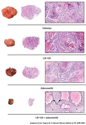 Representative mouse tumors and hematoxylin and eosin-stained tissue are shown for mice treated with vehicle controls, LB-100 alone, adavosertib alone, or the LB-100 and adavosertib combination. The featured tumor from the vehicle control group is the largest, followed by the single-agent treatment groups, and the tumor from the combination treatment group is the smallest. Tissue staining depicts reduced tumor-cell component only with the combination treatment. 