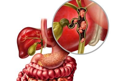 Novel HER2-targeted Bispecific Antibody for Biliary Tract Cancer