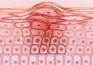 First Approval for a New Immune Checkpoint Inhibitor