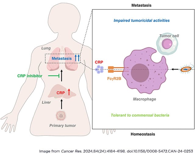 Diagram from the AACR journal Cancer Research that shows how the C-reactive protein can lead to immunosuppression that promotes lung cancer.